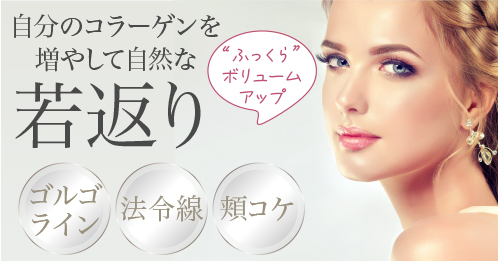 ジュベルックボリューム(レニスナ)