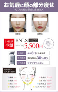 BNLS,BNLS Ultimate,アルティメット,顔痩せ,顔痩せ,小顔,脂肪溶解注射
