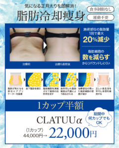 脂肪冷却痩身,ダイエット,医療痩身,メディカルダイエット,CLATUUα,クラツーアルファ,部分痩せ,脂肪細胞,ボディメイク