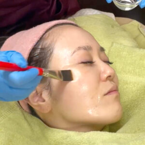ララピール,肌育ピーリング,肌管理,水光肌,lha