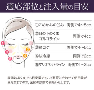 ジュベルックボリューム,レニスナ,肌再生,スキンブースター,肌育注射
