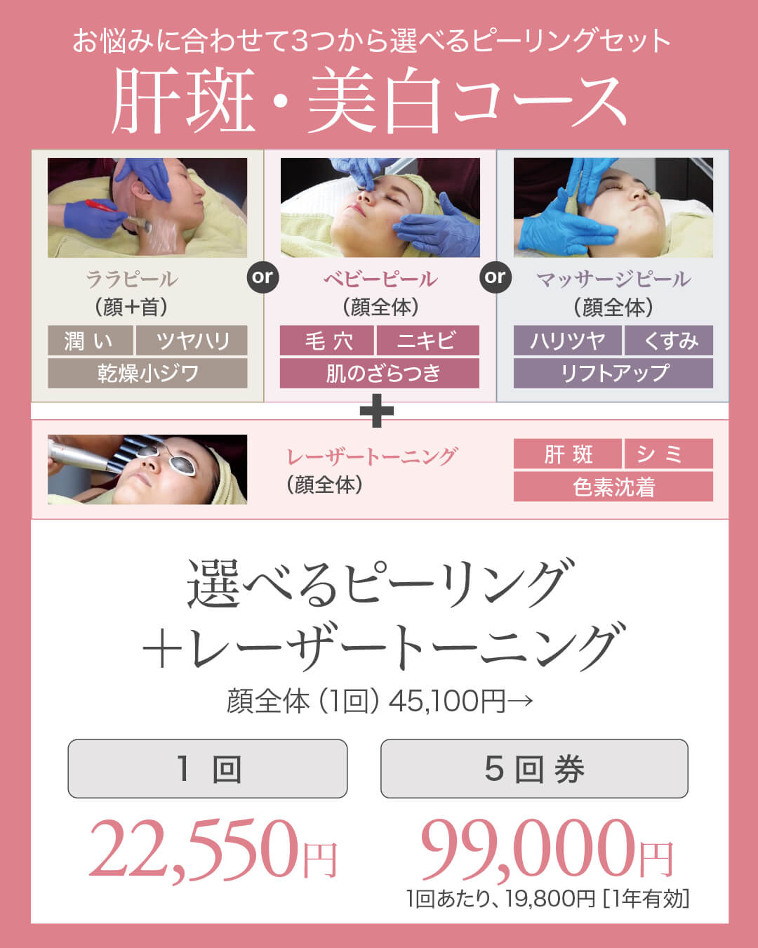 レーザートーニング,肝斑治療,美白治療