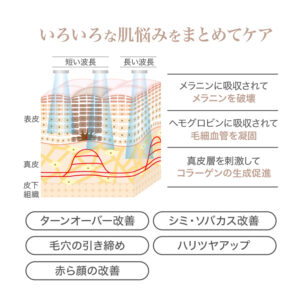 フォトBBL,いろいろな肌悩みをまとめてケア