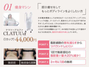 脂肪冷却痩身,クラツーα,CLATUUα,メディカルダイエット,部分痩せ