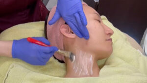 ララピール,肌育ピーリング,肌管理,水光肌,lha