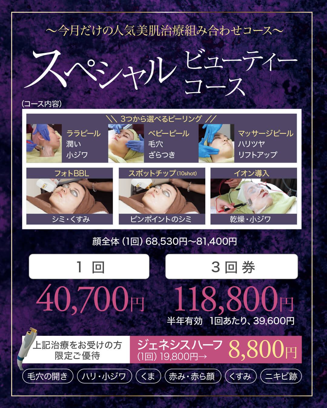 フォトフェイシャル,フォトBBL,BBL光治療,IPL治療,シミ治療,ララピール,ベビーピール,コラーゲンマッサージピール,イオン導入