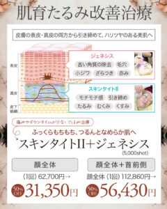 スキンタイトII,ジェネシス,たるみ,毛穴,美肌治療