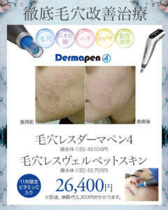 ダーマペン4,ヴェルベットスキン,コラーゲンマッサージピール,毛穴治療,ニキビ跡,